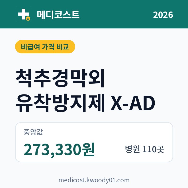 척추경막외 유착방지제 X-AD 가격 비교 2026: 중앙값 273,330원, 병원 110곳