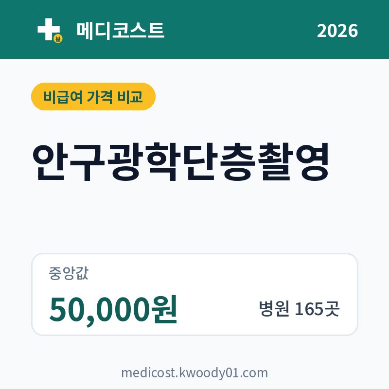 안구광학단층촬영 가격 비교 2026: 중앙값 50,000원, 병원 165곳