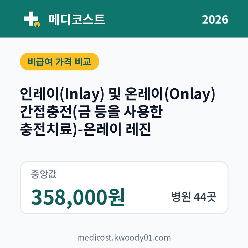 인레이(Inlay) 및 온레이(Onlay) 간접충전(금 등을 사용한 충전치료)-온레이 레진 가격 비교 2026: 중앙값 358,000원, 병원 44곳
